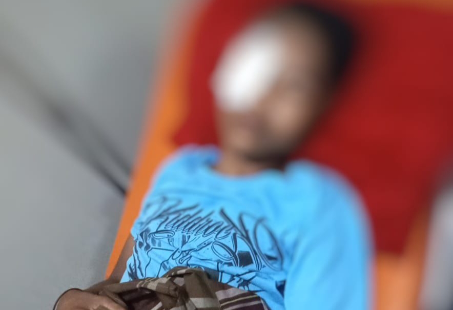 Mata Remaja di Bajeng Gowa Luka Parah Diberondong Peluru Jeli