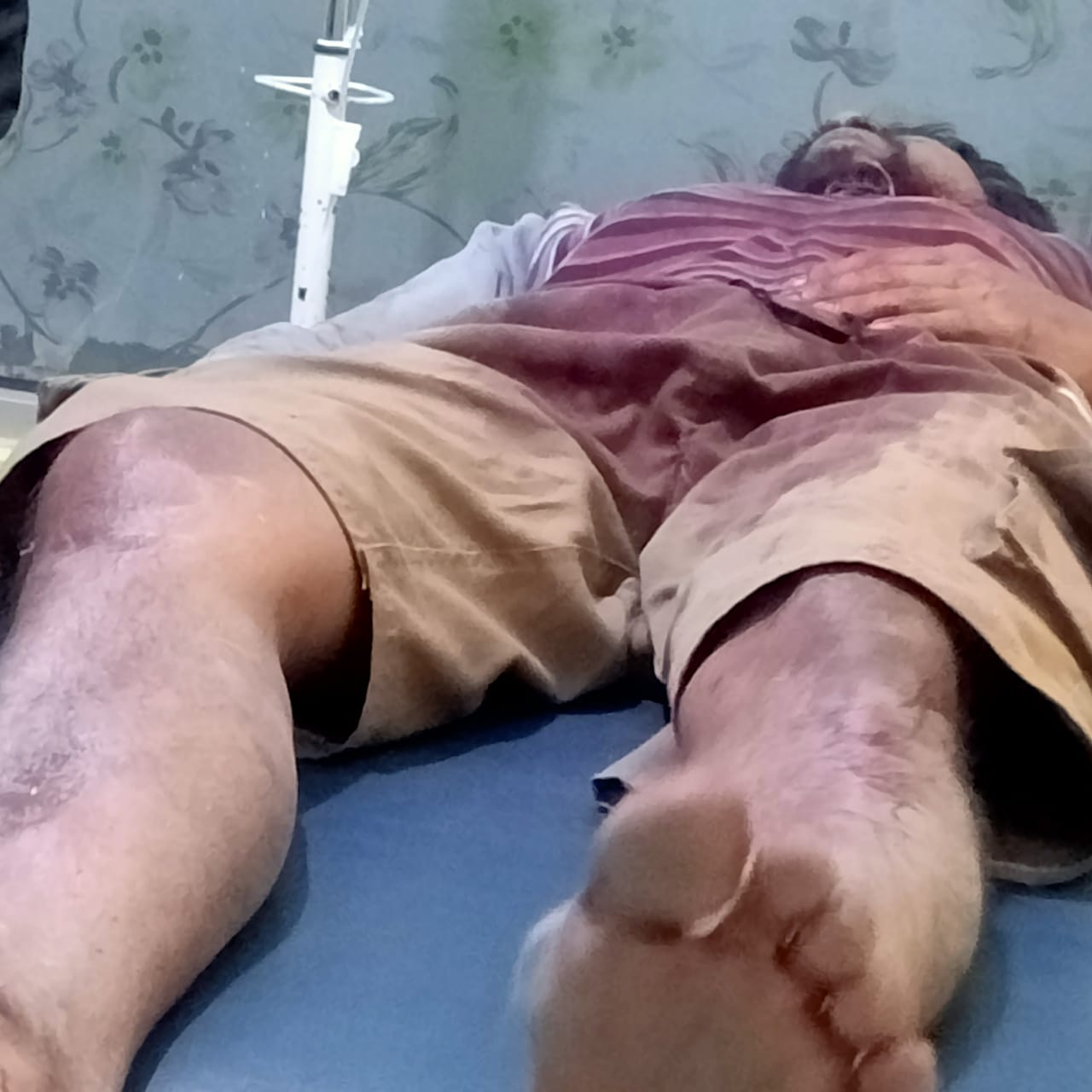 Pesta Ballo di Lonjoboko, Mertua Sambung Tikam dan Tebas Menantu