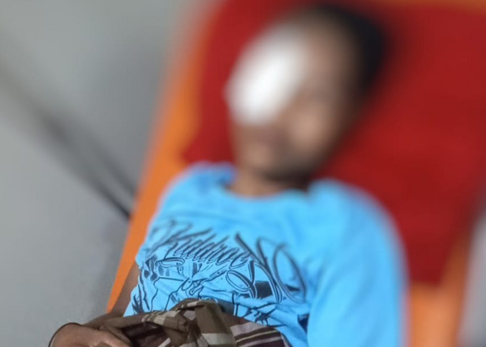 Mata Remaja di Bajeng Gowa Luka Parah Diberondong Peluru Jeli