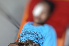 Mata Remaja di Bajeng Gowa Luka Parah Diberondong Peluru Jeli